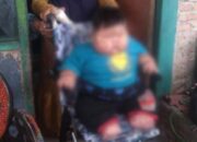 Balita Asal Tarumajaya Bekasi Alamai Obesitas, Bobot Capai 27 Kilogram