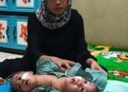 Miris, Bayi Kembar Siam di Lebak Banten, Membutuhkan Bantuan dari Dermawan