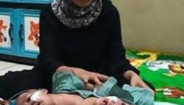 Miris, Bayi Kembar Siam di Lebak Banten, Membutuhkan Bantuan dari Dermawan