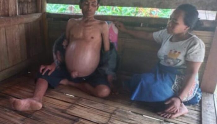 Penderita Gagal Ginjal dan Hati, Mengharapkan Bantuan dari Pemerintah
