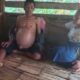 Kondisi Mujani, warga Kampung Kadu Kolecer Rt 02 Rw 04 Desa Babakanlor, Kecamatan Cikedal, Kabupaten Pandeglang mengalami pembengkakan perut. (Foto: istimewah)