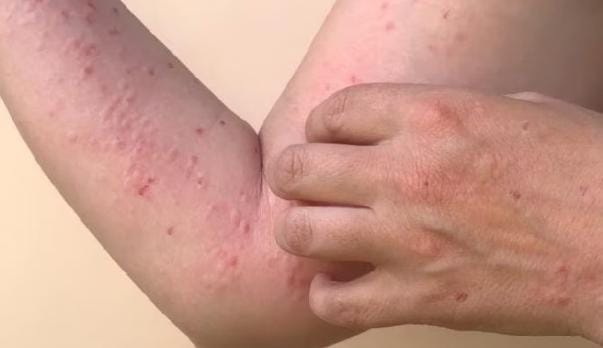 ilustrasi (foto: istimewa)