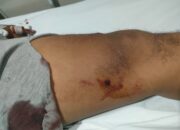 Sadis, Komplotan Perampok di Banten Tembak Warga saat Aksinya Dikepung Massa