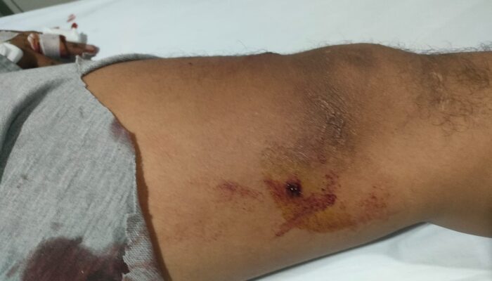 Sadis, Komplotan Perampok di Banten Tembak Warga saat Aksinya Dikepung Massa