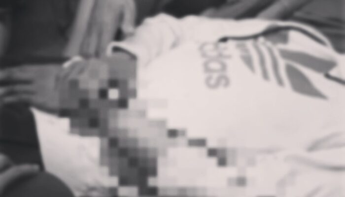 Tawuran di Cabangbungin, Seorang Remaja Luka Bacok Sajam