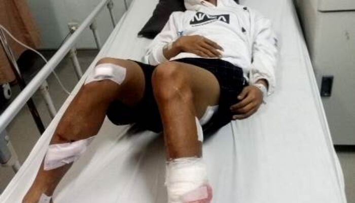 Anak Tongkrongan di Bekasi Berulah, Warga Tambelang jadi Korban Keroyokan dan Pembacokan