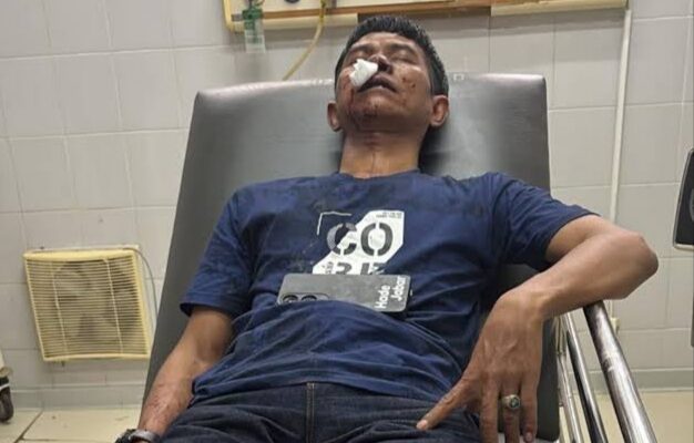 RSUD Ciereng Subang Diduga Beri Keterangan Palsu Soal Visum Wartawan Korban Pemukulan Brutal
