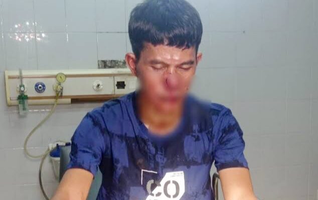 Satpoldam Abaikan Perintah Gubernur Jabar, Jadi Faktor Pemicu Pemukulan Brutal Wartawan Subang