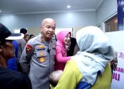 Menuju HUT Bhayangkara ke-80, Polda Banten Melaksanakan Operasi Bibir Sumbing Gratis kepada 25 Anak